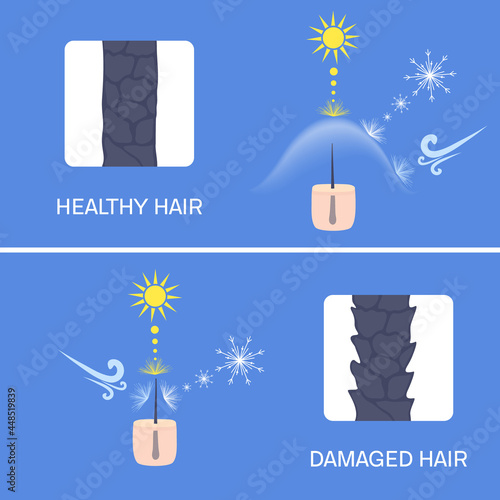 Hair protection shield from environmental effects of sun UV rays, cold weather and wind. Hair damage prevention concept. Before after result in close up. Medical vector illustration.