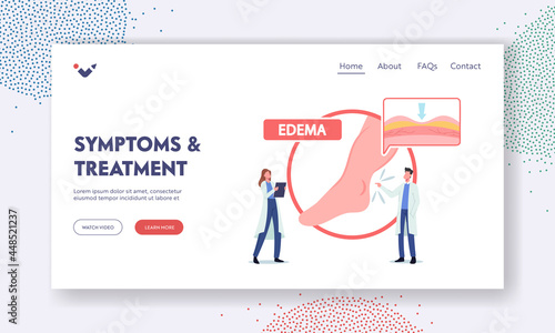 Edema Symptoms and Treatment Landing Page Template. Tiny Doctor Characters Presenting Huge Infographics