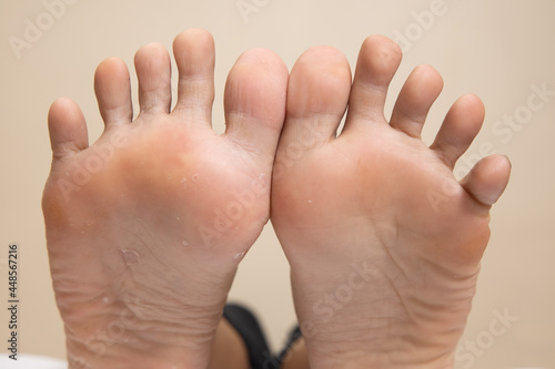 Closeup of a female foot sole  on a white background © Teerapong