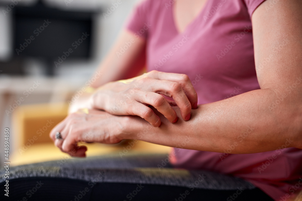 Woman with itchy, tingling arms scratching skin.