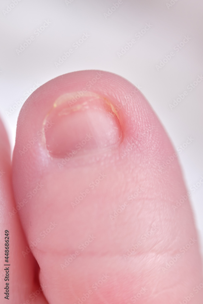 Fototapeta premium Toes on the foot of a newborn baby, close-up. Macro photo of a healthy toe of a child