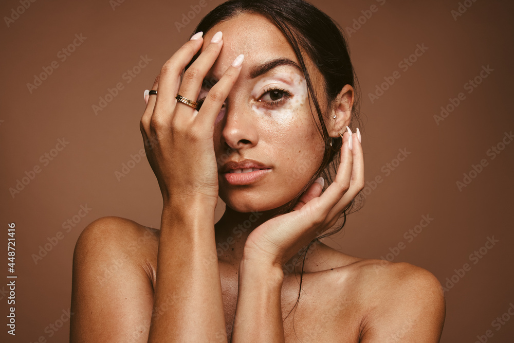 Fototapeta premium Insecurities of women due to skin problems
