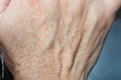 Closeup of human hand with wrinkles in deep layer skin and veins Skin repair and treatment for elderly and aged people © TS.PHOTOS
