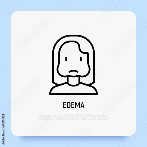Edema thin line icon, woman with swollen cheeks. Allergy symptom. Modern vector illustration