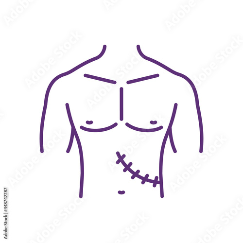 Removed organ aftermath RGB color icon. Surgery recovery. Illicit organ transplant surgery. Body parts and tissues trafficking. Isolated vector illustration. Simple filled line drawing