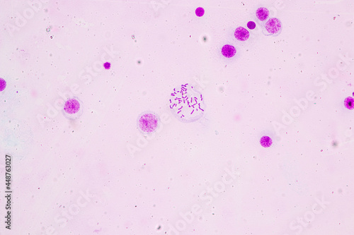 Chromosomes Human under the microscope for education. 