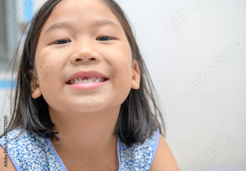 Asian kid girl smile and showing her broken milk teeth. Oral heath concept .