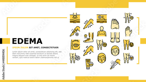 Edema Disease Symptom Landing Web Page Header Banner Template Vector. Venous And Fatty, Lymphatic And Hypoproteinemic, Allergic And Heart Edema Health Problem Illustration