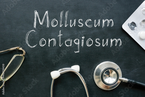 Molluscum contagiosum is shown on the medical photo using the text photo