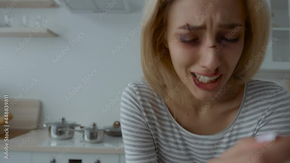 Victim of domestic violence. Young woman with battered face crying at kitchen, suffering from aggressive husband abuser Victim of domestic violence. Young woman with battered face crying at kitchen, suffering from aggressive husband abuser