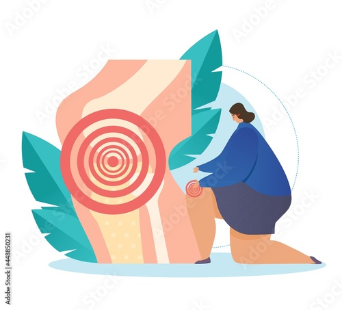 Joint pain concept. Woman complains of pain in knee joint. Discomfort while walking. Treatment of arthritis. Inflammatory process. Cartoon flat vector illustration isolated on white background