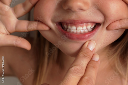 Little girl smiles and shows her snow-white smile, teeth. The child is brushing his teeth.
