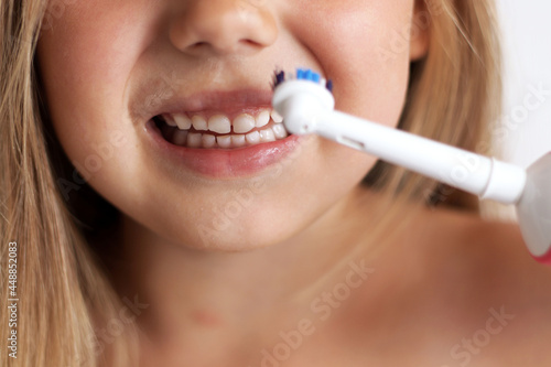 Little girl smiles and shows her snow-white smile  teeth. The child is brushing his teeth.
