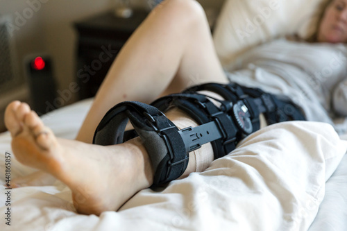 Woman's leg Stabilized with Black Orthopedic Brace photo