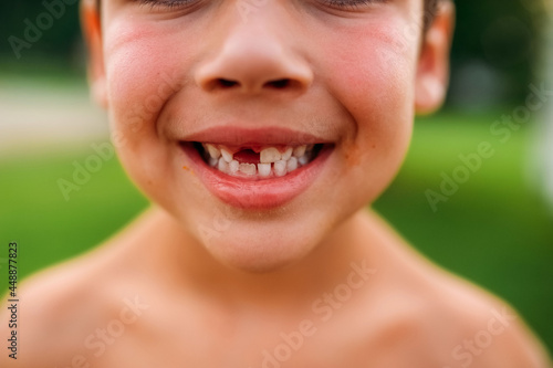 Closeup portrait of a child's gappy smile. 