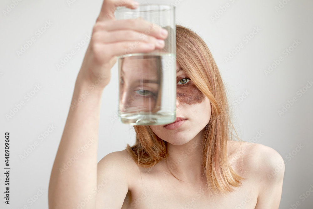 Young bare shouldered female with dark pigment spot under eye looking at camera through transparent glass with water Young bare shouldered female with dark pigment spot under eye looking at camera through transparent glass with water