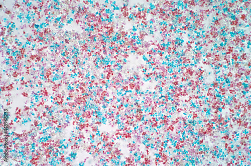 Obraz na plátně Saccharomyces cerevisiae yeast budding cell under the light microscope