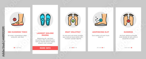 Flat Feet Disease Onboarding Mobile App Page Screen Vector. Orthopedic Insoles And Shoes, Inward And Outward Curvature Of Legs, Flat Feet Treatment Illustrations