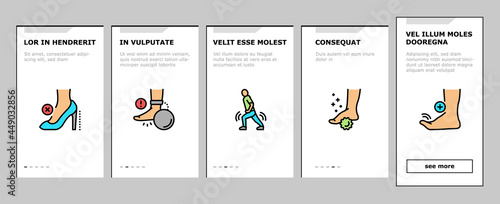 Flat Feet Disease Onboarding Mobile App Page Screen Vector. Orthopedic Insoles And Shoes, Inward And Outward Curvature Of Legs, Flat Feet Treatment Illustrations