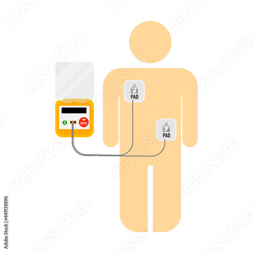 Illustration of a cartoon character for basic life support. AED pads on skin.