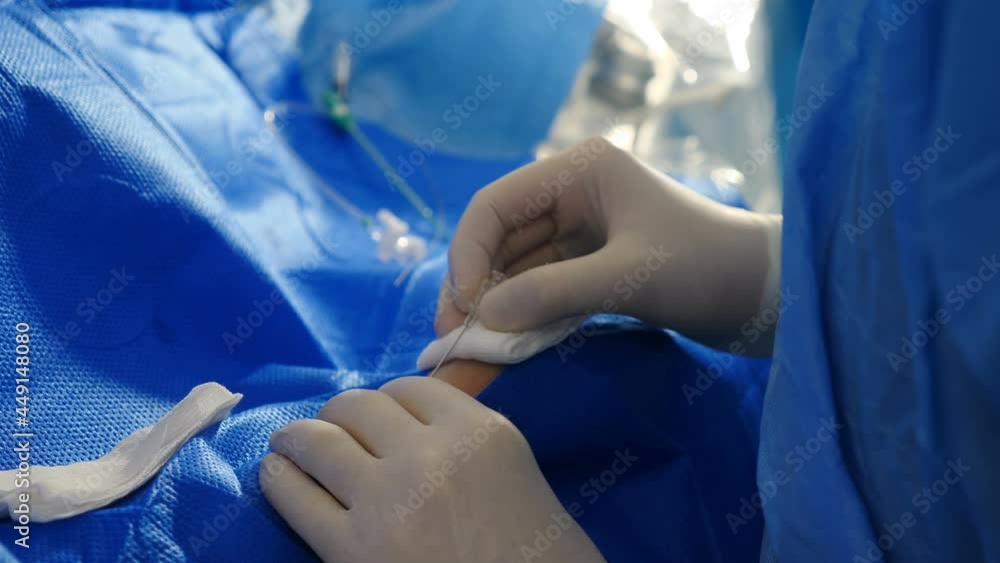 Endovascular surgery procedure. Doctor making puncture in body before operation. Close up of