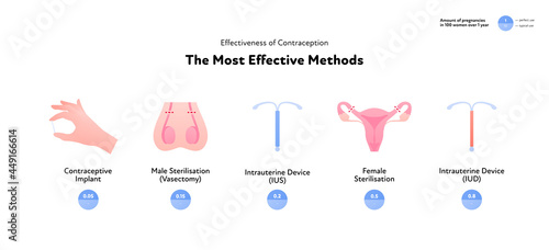 Effectiveness of contraception method infographic. Vector flat color icon illustration. Most effective contraceptive methods. Pearl rate index. Design for birth control and pregnancy prevention.