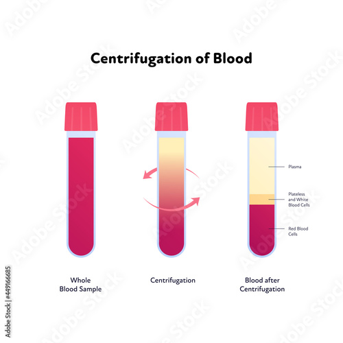 Blood analysis infographic. Vector flat healthcare illustration. Centrifugation. Whole blood sample to divided. Design for pharmacy, health care.