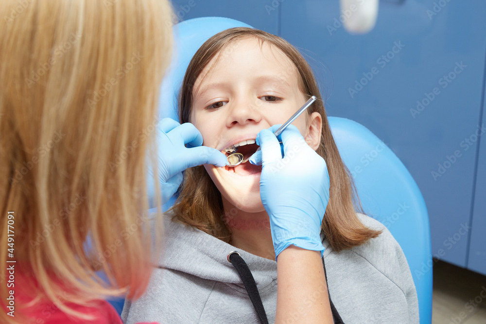Wizyta u ortodonty - obrazy, fototapety, plakaty 