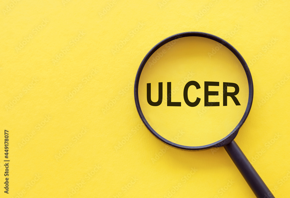 Medical and ulcer symbol. Magnifying glass with the concept word ulcer on yellow background. Medical and ulcer symbol. Magnifying glass with the concept word ulcer on yellow background.