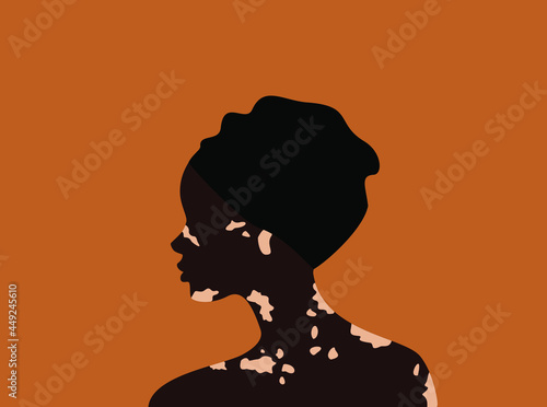 Side view of african woman in turban with vitiligo on an orange background. Body positive concept. Flat vector illustration