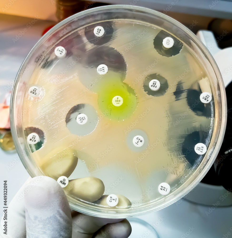 Antimicrobial susceptibility testing in petri dish. Antibiotic