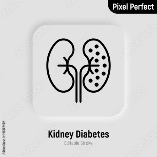 Kidneys diabetes thin line icon. Chronic disease. Pixel perfect, editable stroke. Vector illustration.