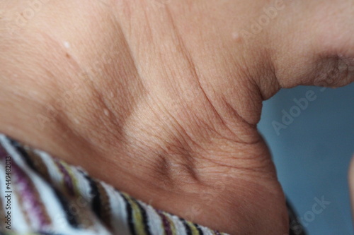 Closeup of wrinkles in woman neck skin in deep layers Skin repair and treatment concept for elderly and aged people. Healthcare medical and aesthetic concept