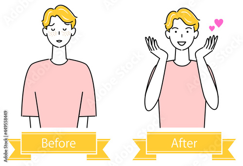 スキンケア 顔のお肌トラブル"シミ・そばかす"のビフォーアフター 可愛い男性のイラスト ベクター
