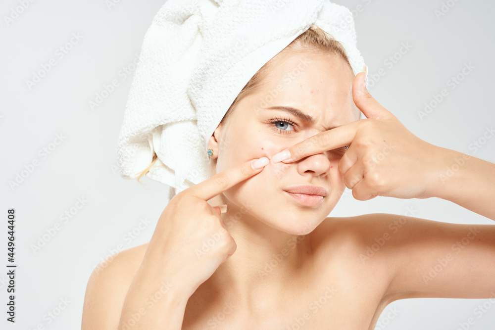 woman with bare shoulders with a towel on her head acne dermatology woman with bare shoulders with a towel on her head acne dermatology