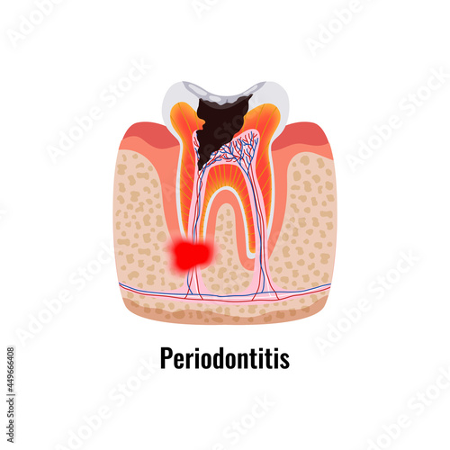 Dental Problem Poster