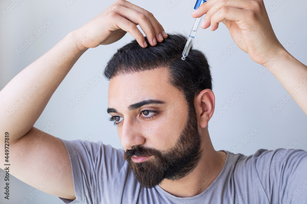 Man baldness treatment. Nature hair care procedure. Oil drop at scalp. Male  person applying dermatology lotion. Home routine. trichologist cosmetic  product. Anti hairloss clinic mask Stock Photo | Adobe Stock
