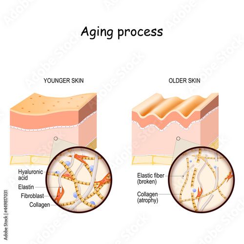 Aging process photo