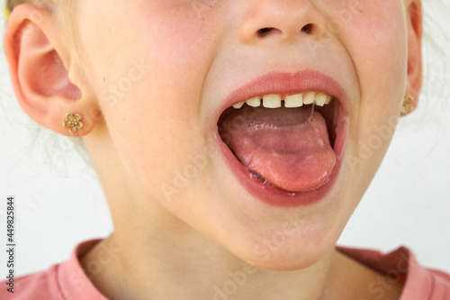 saliva. Drooling on the tongue in kid mouth. Cheerful smile child. close-up of face on white background. little girl show tongue, throat. portrait with wide open mouth and protruding tongue. photo