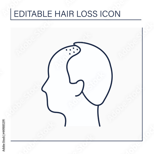 Hair loss line icon. Man loses hair. Male pattern baldness. Alopecia concept. Isolated vector illustration. Editable stroke