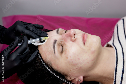 Cosmetologist doctor is making multiple injections biorevitalization with hyaluronic acid in woman face skin, closeup. Woman on the procedure of mesotherapy injection