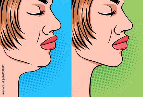 Woman double chin tightening before and after the procedure, vector illustration in pop art comics style