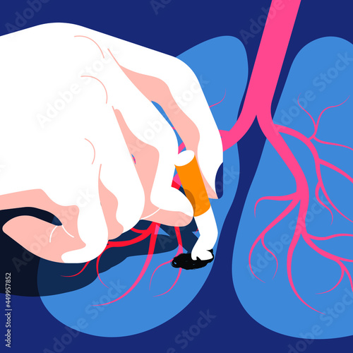 Global Health - Drug Abuse - putting out a cigarette in a lung