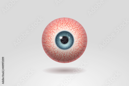 Reddened human eyeball with many distinct blood vessels