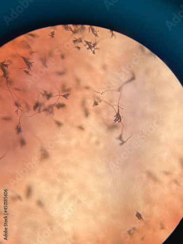 growth of fugus mycelium under microscope photo