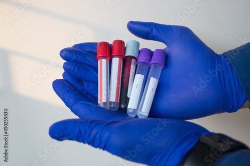 Close-up of a Hand Holding a Test Tube Filled with Blood