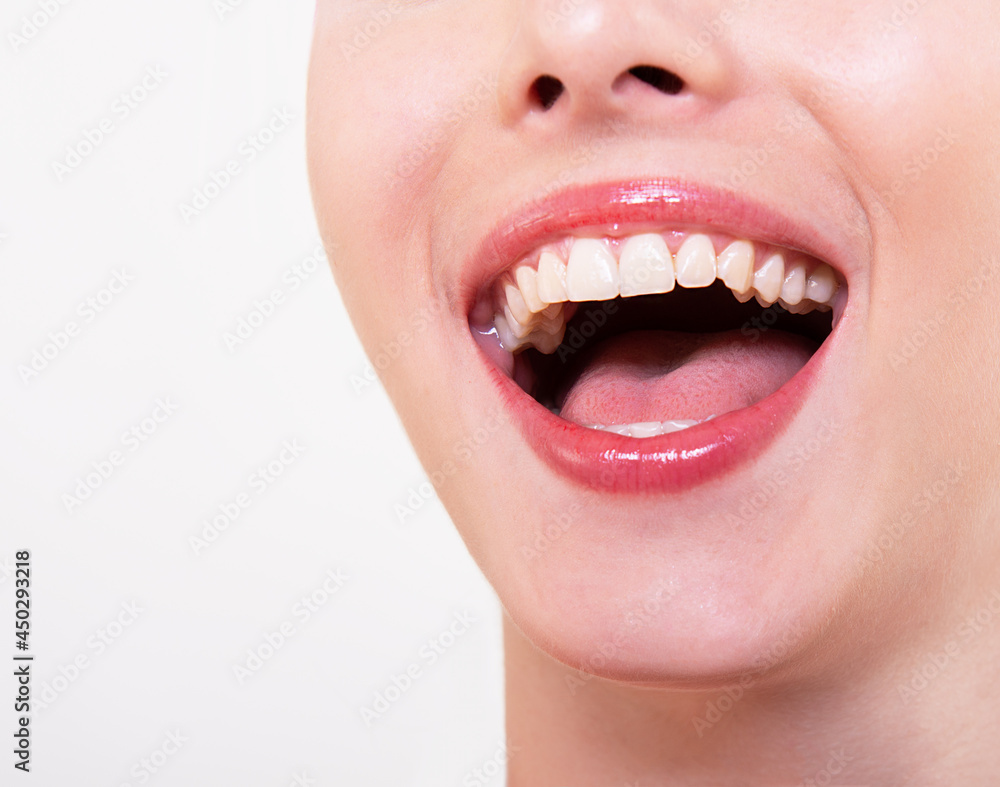 Smile. healthy and beautiful. Laughing woman, female mouth with great teeth over white background. Teeth health, whitening, prosthetics and care. Happiness and joy Smile. healthy and beautiful. Laughing woman, female mouth with great teeth over white background. Teeth health, whitening, prosthetics and care. Happiness and joy