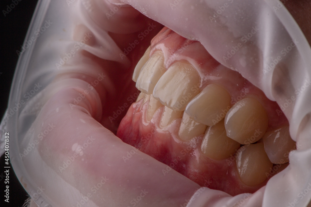 Obraz premium Dentistry