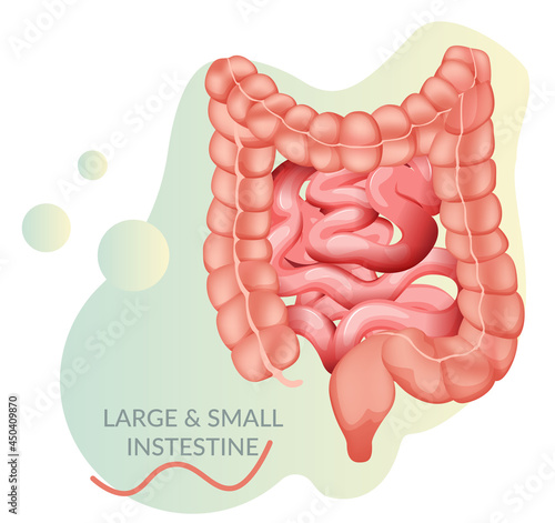 Large Intestine - Stock Illustration