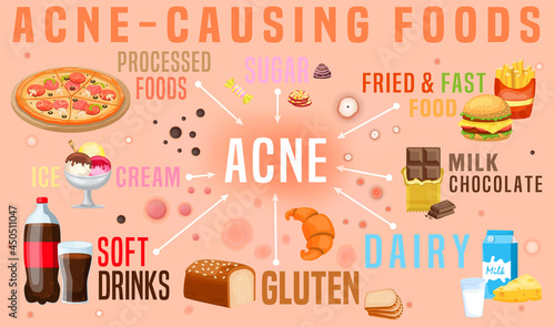 What causes acne. Acne-causing food. Horizontal poster